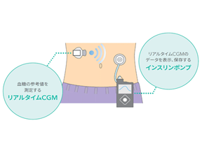 &ldquo;かくれ血糖&rdquo;を見える化してみよう！